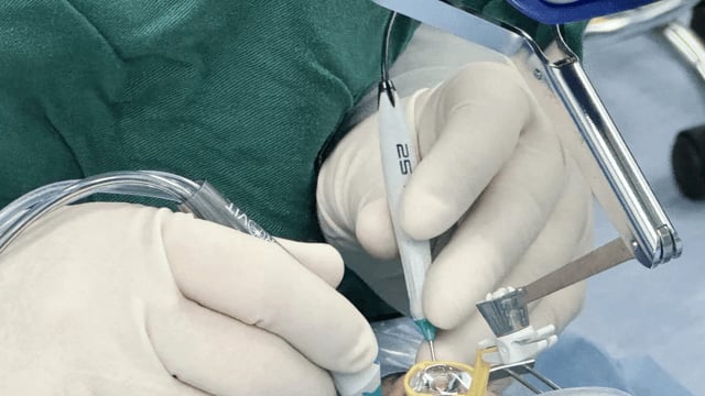 5分钟“种”出新软骨！大湾区首批软骨再生手术落地公立医院